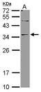 Deoxyribonuclease 2 Beta antibody, PA5-31390, Invitrogen Antibodies, Western Blot image 