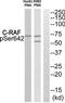 Raf-1 Proto-Oncogene, Serine/Threonine Kinase antibody, TA313057, Origene, Western Blot image 