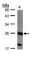 Cancer-related nucleoside-triphosphatase antibody, LS-C185973, Lifespan Biosciences, Western Blot image 