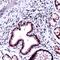 Hsc70-interacting protein antibody, PA5-32600, Invitrogen Antibodies, Immunohistochemistry paraffin image 