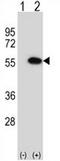Ribosomal Oxygenase 2 antibody, AP52698PU-N, Origene, Western Blot image 