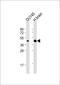 5-Hydroxytryptamine Receptor 1E antibody, M08598, Boster Biological Technology, Western Blot image 