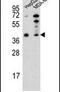 Poly(ADP-Ribose) Polymerase Family Member 16 antibody, PA5-25891, Invitrogen Antibodies, Western Blot image 
