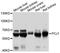 Phosphoenolpyruvate carboxylase antibody, MBS127666, MyBioSource, Western Blot image 