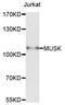 Muscle Associated Receptor Tyrosine Kinase antibody, MBS127720, MyBioSource, Western Blot image 