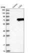Leucine Rich Repeat LGI Family Member 2 antibody, NBP1-83839, Novus Biologicals, Western Blot image 