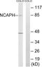 Non-SMC Condensin I Complex Subunit H antibody, A30627, Boster Biological Technology, Western Blot image 