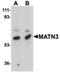 Matrilin 3 antibody, PA5-20727, Invitrogen Antibodies, Western Blot image 