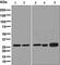 S-methyl-5 -thioadenosine phosphorylase antibody, ab126770, Abcam, Western Blot image 