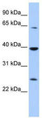 Cytosolic Iron-Sulfur Assembly Component 1 antibody, TA335736, Origene, Western Blot image 