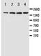 GRIN2B antibody, PA1059, Boster Biological Technology, Western Blot image 