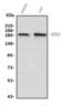 Histone-lysine N-methyltransferase SETD1A antibody, A03736-1, Boster Biological Technology, Western Blot image 