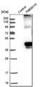 Transmembrane Protein 115 antibody, NBP1-80898, Novus Biologicals, Western Blot image 