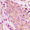 SMAD2 antibody, LS-C352472, Lifespan Biosciences, Immunohistochemistry paraffin image 