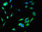 Secreted Frizzled Related Protein 1 antibody, CSB-PA021138LA01HU, Cusabio, Immunofluorescence image 