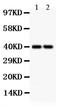 Secreted frizzled-related protein 4 antibody, RP1067, Boster Biological Technology, Western Blot image 