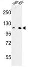 Microsomal Triglyceride Transfer Protein antibody, AP52771PU-N, Origene, Western Blot image 