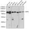 Dipeptidyl Peptidase 3 antibody, 14-966, ProSci, Western Blot image 