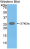 Diacylglycerol O-acyltransferase 1 antibody, LS-C294118, Lifespan Biosciences, Western Blot image 