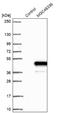 Zinc Finger Protein 843 antibody, NBP2-48599, Novus Biologicals, Western Blot image 