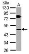 Collagen Like Tail Subunit Of Asymmetric Acetylcholinesterase antibody, LS-C155496, Lifespan Biosciences, Western Blot image 