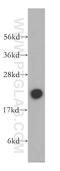 RB Binding Protein 9, Serine Hydrolase antibody, 12230-2-AP, Proteintech Group, Western Blot image 
