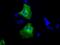 Calcium/Calmodulin Dependent Protein Kinase ID antibody, MA5-25045, Invitrogen Antibodies, Immunocytochemistry image 