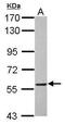 DnaJ Heat Shock Protein Family (Hsp40) Member C3 antibody, PA5-29296, Invitrogen Antibodies, Western Blot image 