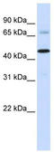 Sideroflexin 4 antibody, TA337638, Origene, Western Blot image 