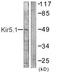 Potassium Voltage-Gated Channel Subfamily J Member 16 antibody, TA311641, Origene, Western Blot image 