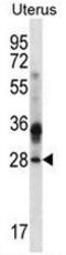 Calcium And Integrin Binding Family Member 4 antibody, AP50923PU-N, Origene, Western Blot image 