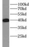 CD7 Molecule antibody, FNab10479, FineTest, Western Blot image 