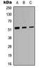 Protein C, Inactivator Of Coagulation Factors Va And VIIIa antibody, LS-C358252, Lifespan Biosciences, Western Blot image 
