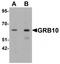 Growth factor receptor-bound protein 10 antibody, TA319657, Origene, Western Blot image 