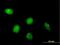 Chromosome 8 Open Reading Frame 33 antibody, H00065265-B01P, Novus Biologicals, Immunocytochemistry image 