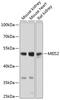 Homeobox protein Meis2 antibody, 23-583, ProSci, Western Blot image 