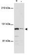Mdm2-binding protein antibody, GTX48646, GeneTex, Western Blot image 