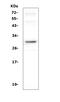 Deoxycytidine Kinase antibody, A01655-1, Boster Biological Technology, Western Blot image 
