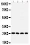 BCL10 Immune Signaling Adaptor antibody, PA1504, Boster Biological Technology, Western Blot image 