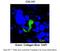 Collagen Type I Alpha 1 Chain antibody, ARP59999_P050, Aviva Systems Biology, Immunohistochemistry paraffin image 