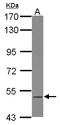 BLK Proto-Oncogene, Src Family Tyrosine Kinase antibody, LS-C155194, Lifespan Biosciences, Western Blot image 
