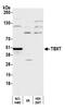 T antibody, A305-889A-M, Bethyl Labs, Western Blot image 