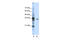 Exosome complex exonuclease RRP40 antibody, 29-225, ProSci, Enzyme Linked Immunosorbent Assay image 