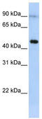 Eosinophil Peroxidase antibody, TA346196, Origene, Western Blot image 
