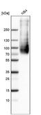 Neutral amino acid transporter B(0) antibody, NBP1-89327, Novus Biologicals, Western Blot image 