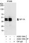 Nuclear transcription factor Y subunit alpha antibody, A302-104A, Bethyl Labs, Immunoprecipitation image 