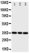Integrin Binding Sialoprotein antibody, PA1887, Boster Biological Technology, Western Blot image 