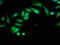 Inositol Polyphosphate-5-Phosphatase B antibody, LS-C669657, Lifespan Biosciences, Immunofluorescence image 