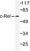 REL Proto-Oncogene, NF-KB Subunit antibody, LS-C176198, Lifespan Biosciences, Western Blot image 