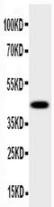 Hydroxysteroid 17-Beta Dehydrogenase 2 antibody, PA1604, Boster Biological Technology, Western Blot image 